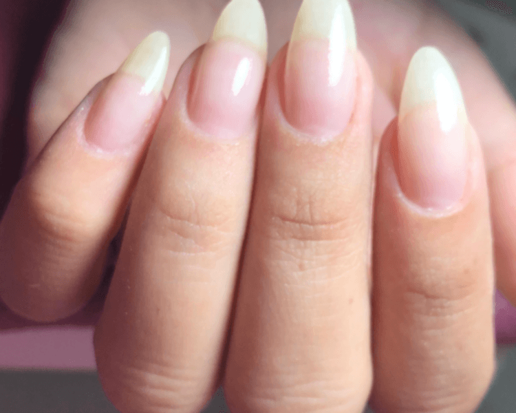 Retiro semi/kapping con belleza y calcio