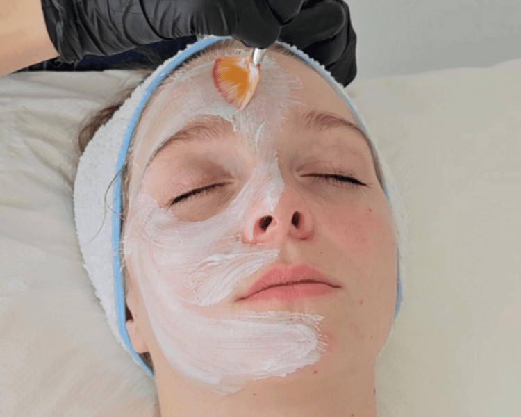 PEELING QUÍMICO DE VERANO HASTA EL 31/03 X 1 SESIÓN