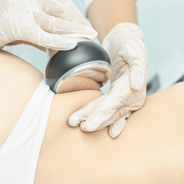 Reductivo abdominal con LIPOACTIVE RF una sesión