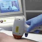 Depilación Definitiva photo