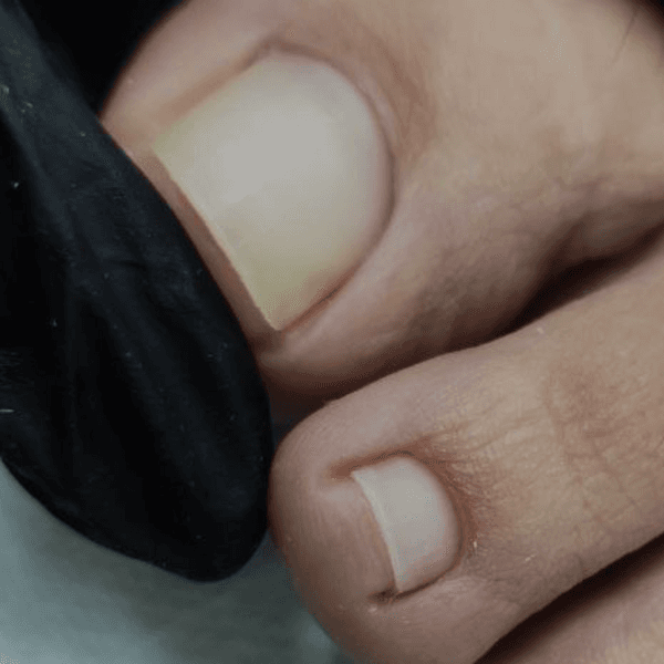 Pies: Limpieza de cutículas, incluye retiro de esmaltado permanente