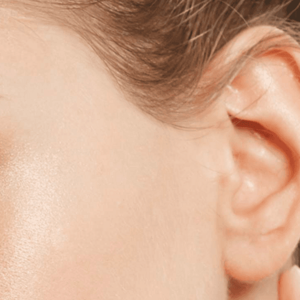 Depilacion de Rostro