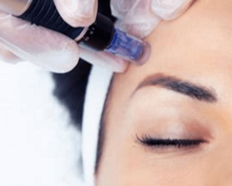 MICRONEEDLING C/SERUMS INDICADOS