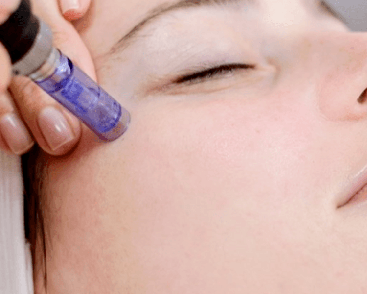 Dermapem $70.000 HASTA 3 CUOTAS s/INTERES