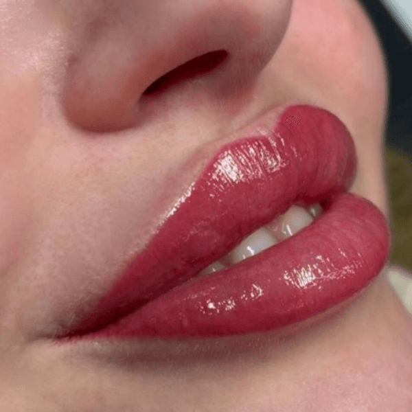 REVIVE LIPS (micro Labial entre 1 a 2 años después de realizado)