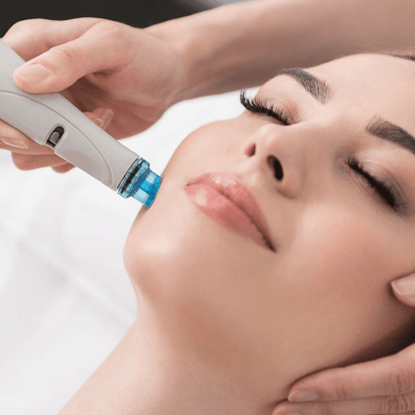 Hydra Peel (Pack x 4 sesiones)