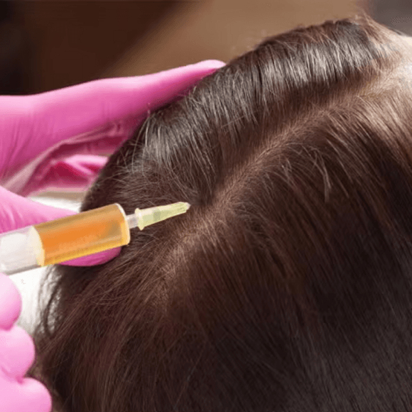 PLASMA ENRIQUECIDO PARA LA CAÍDA DEL CABELLO