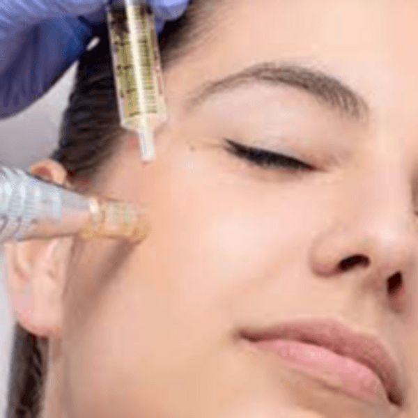 PLASMA ENRIQUECIDO EN PLAQUETAS