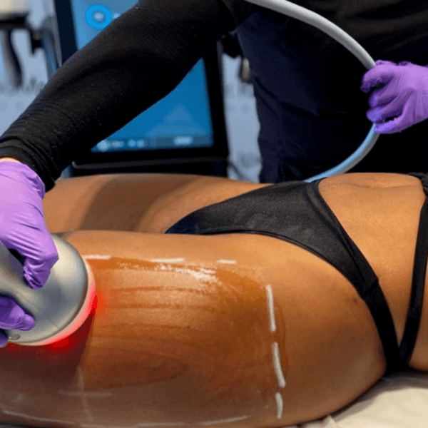 Paquete de 4 procedimientos Lipomax (12 sesiones)