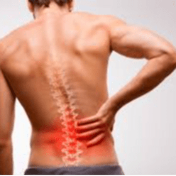 Tratamiento para lumbalgia