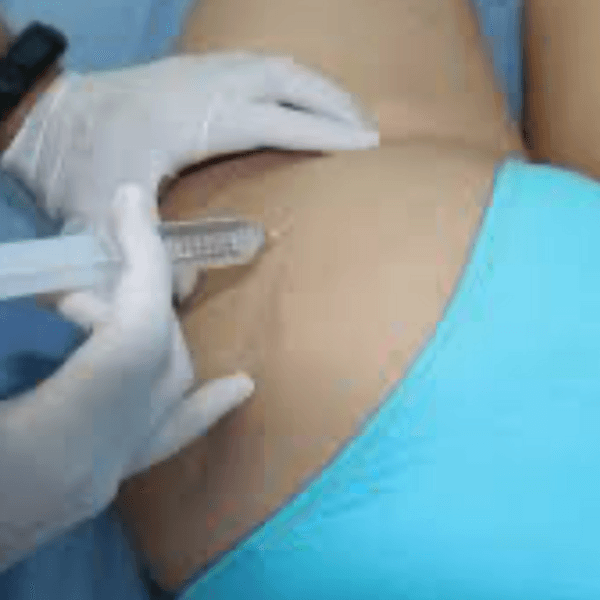 Celulitis Tratamiento de Ozono/ Cellulitis Ozone Treatment ( 6 sesiones)