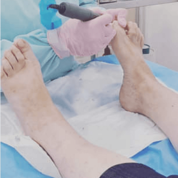 Atención Básica Podología