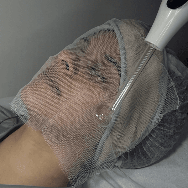 Limpieza Facial Profunda + Mascarilla casmara