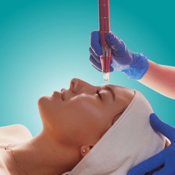 DERMAPEN/MICRONEEDLING PARA CICATRICES - 1 SESIÓN