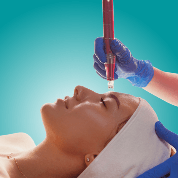 DERMAPEN/MICRONEEDLING PARA CICATRICES- 3 SESIONES