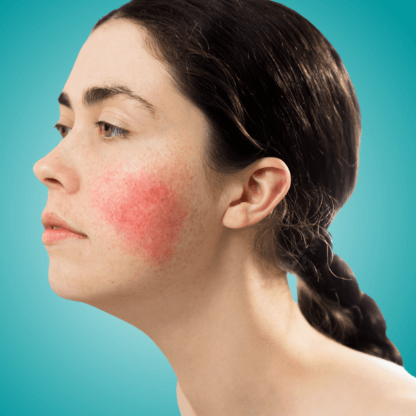 LIMPIEZA PIELES SENSIBLES