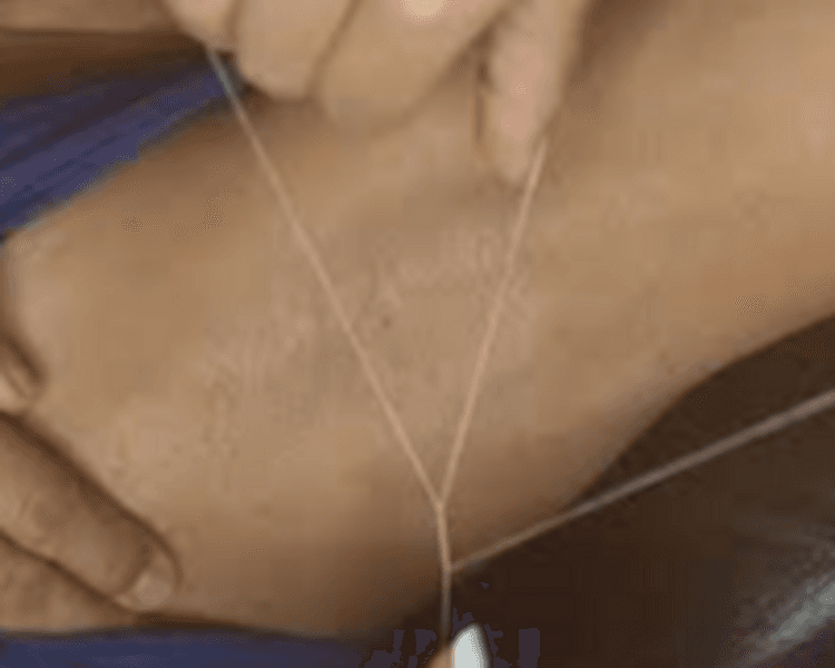 EPILACION DE AXILAS