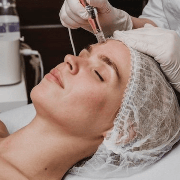 REJUVENECIMIENTO FRAX+DERMAPEN