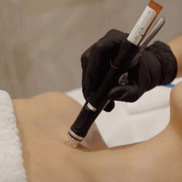Hydrafacial Cuello y Escote - Epicutis