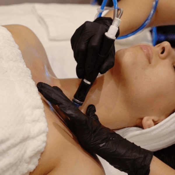 Hydrafacial Platinum + Cuello + Escote (Epicutis)