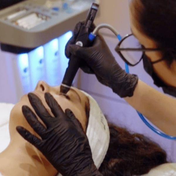 Hydrafacial Perk - Ojos