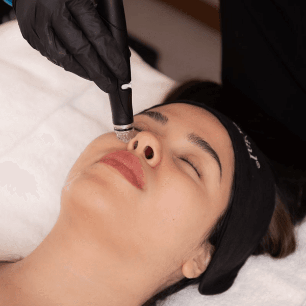 Hydrafacial Plus Signature