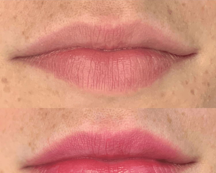 👄 Micropigmentación de Labios + Refuerzo
