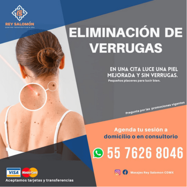 Eliminación de verrugas