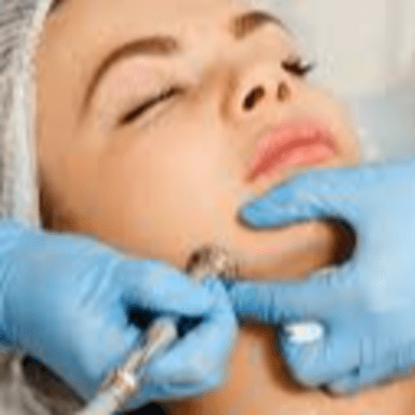 Microdermoabrasión- Punta de diamante