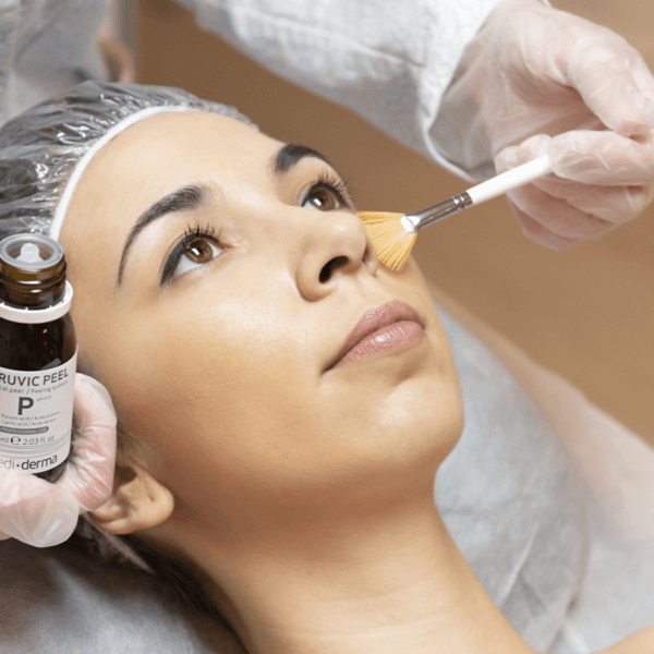 Peeling Cosmeceutico Nacional