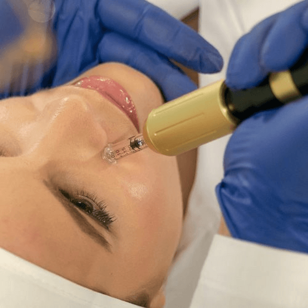 Hyaluron Pen vacuna antiage con ampollas estèriles- vit C, aminoàcidos, multivitaminas, adn vegetal, niacinamida, hialurònico