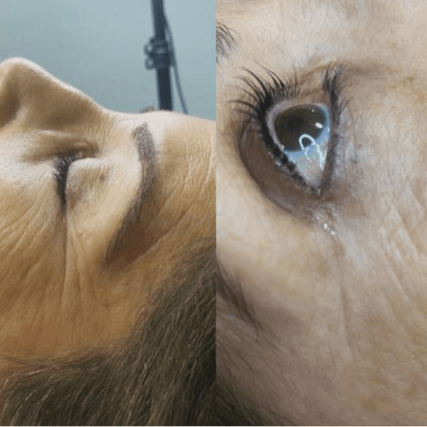 Lifting + Tinte o Botox