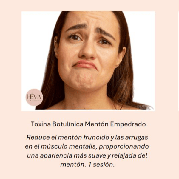 Toxina Mentón Empedrado