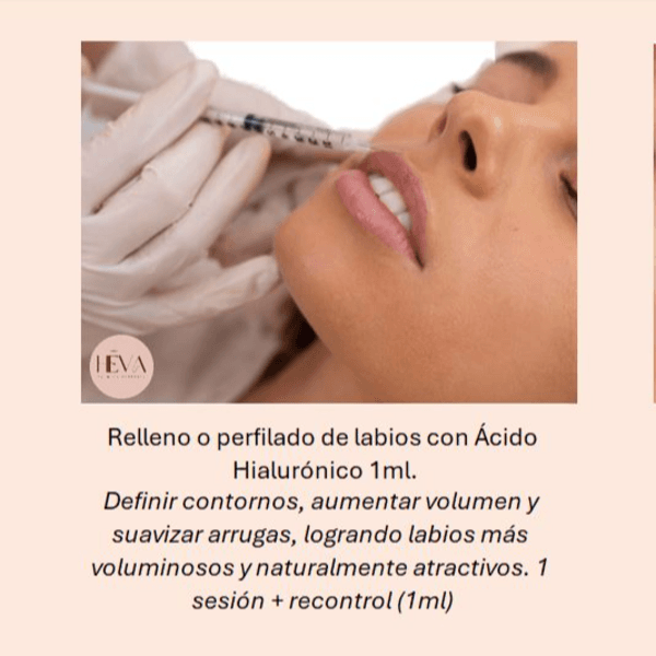 Hialurónico Relleno o Perfilado de Labios