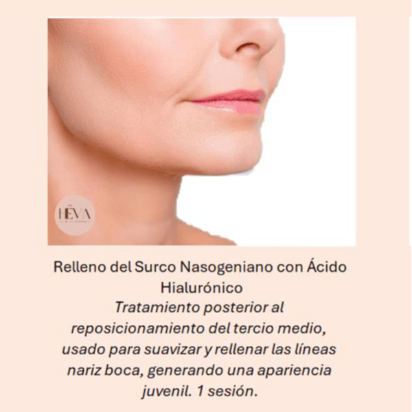 Hialurónico Relleno Surco Nasogeniano