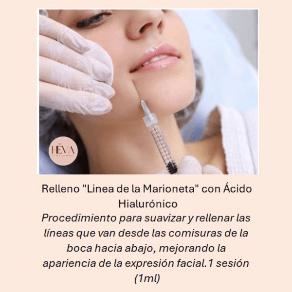 Hialurónico Línea de la Marioneta