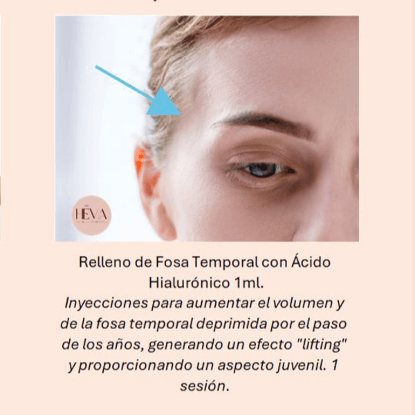 Hialurónico Relleno de Fosa Temporal