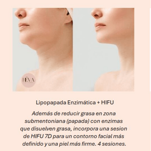 Lipo Papada Enzimática + HIFU