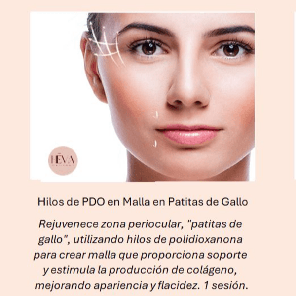 Hilos PDO Patas de Gallo (20u.)