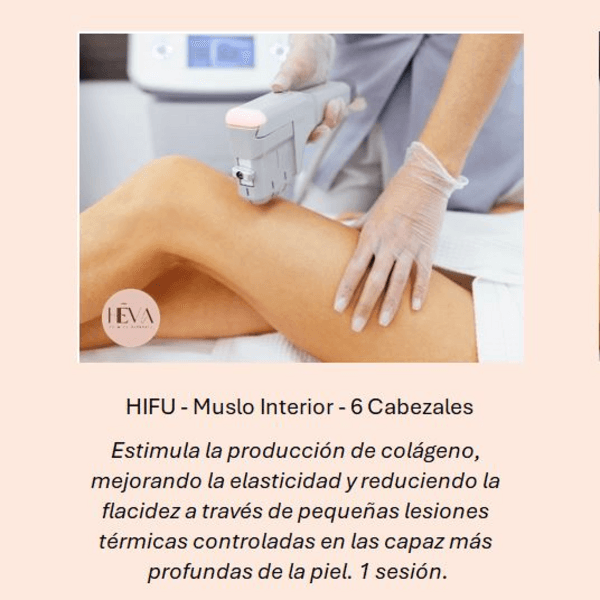 HIFU Muslo Interior 6 Cabezales